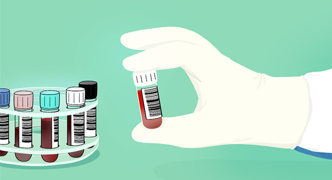 1595554213693878.jpg 進口胎牛血清關(guān)